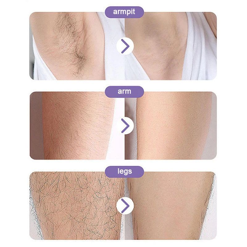 Crystal Hair Remover - Portable Epilator For Men And Women Full Body - Magic Crystal Hair Removal Eraser