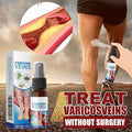Varicose Vein Spray Herbal Body Care for Vasculitis And Phlebitis Relief