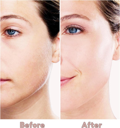 Rechargeable Flawless Hair Removal Machine for Women Painless Facial Hair Remover Ladies Shaver Trimmer for Women Flawless Laser Hair Removal Machine