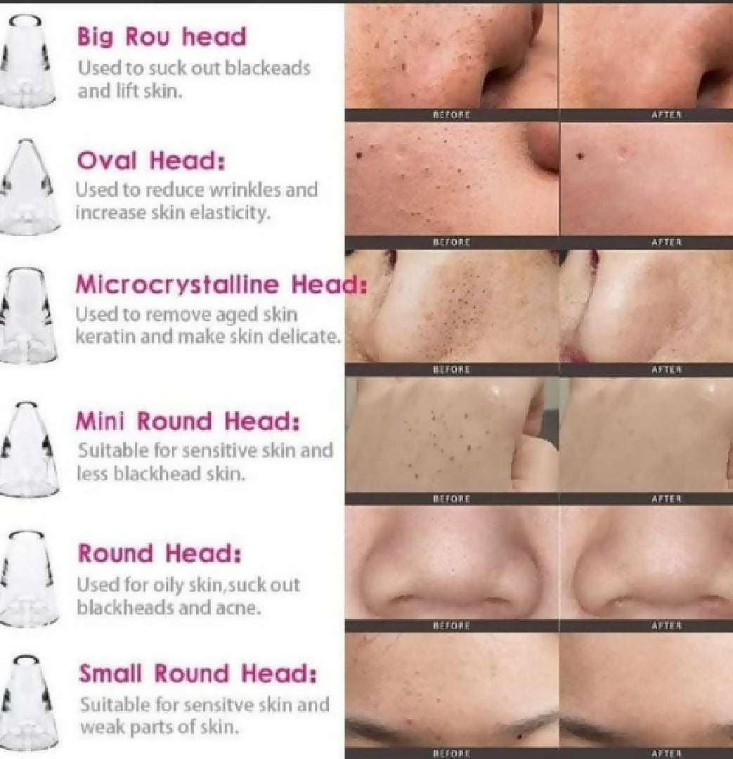 Electric Blackhead Remover Vacuum Pore Cleaner